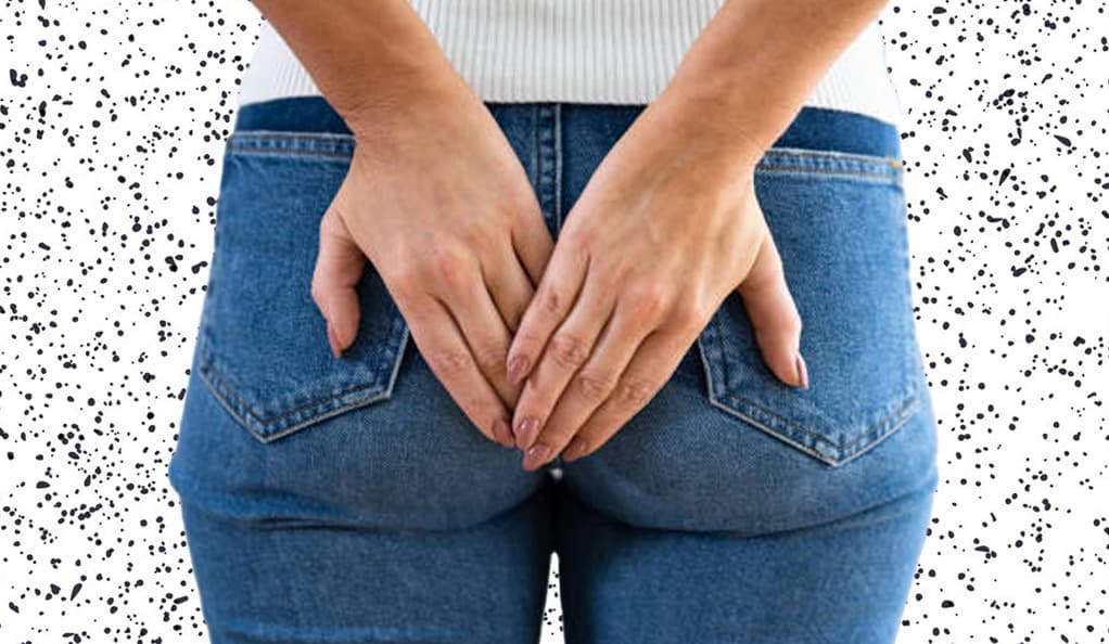 Anal Fistula