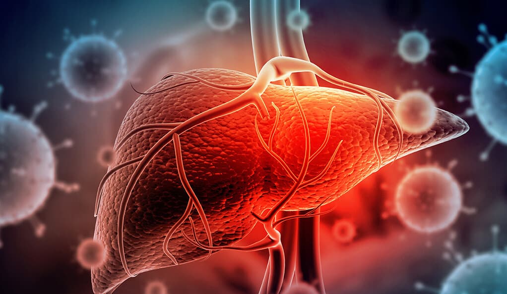 Fatty Liver