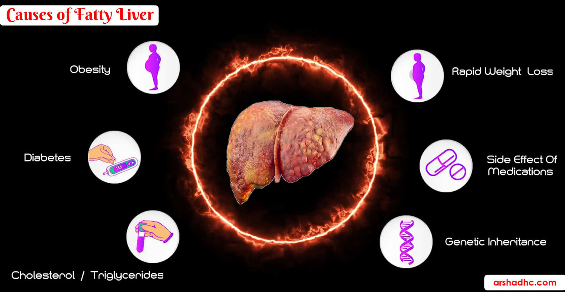 causes of fatty liver